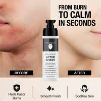 UrbanMooch Instant Relief After Shave Lotion for Men with Witch Hazel Extract, A...